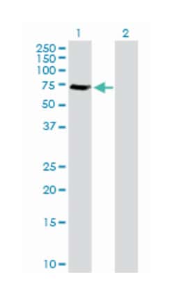 golgi associated, gamma adaptin ear containing, ARF binding protein 1,