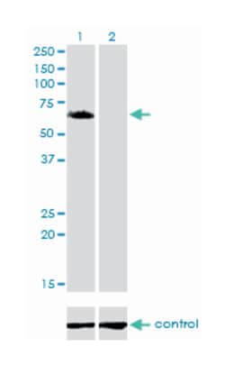 golgi associated, gamma adaptin ear containing, ARF binding protein 1,