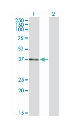 B3GAT3, Mouse, Clone: 4C12, Abnova 200&mu;L; Unlabeled:Antibodies, Monoclonal