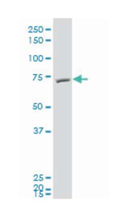 F-box and leucine-rich repeat protein 5, Mouse, Polyclonal Antibody, Abnova 50 &mu;L | Buy Online | Abnova | Fisher Scientific