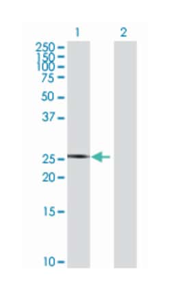 tetraspanin 17, Mouse, Polyclonal Antibody, Abnova 50&mu;L; Unlabeled:Antibodies,