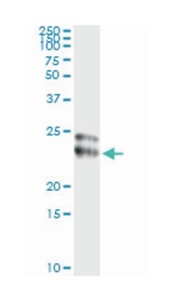 FGF21, Mouse, Clone: 1A8, Abnova 100&mu;g; Unlabeled:Antibodies, Monoclonal