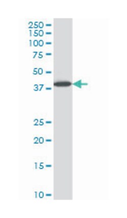 LIM homeobox 6, Mouse, Clone: 3E8, Abnova 100&mu;g; Unlabeled:Antibodies,