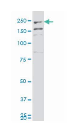 myoferlin, Mouse, Polyclonal Antibody, Abnova 50&mu;L; Unlabeled:Antibodies,