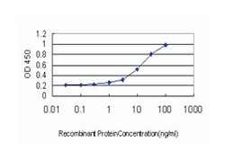 gremlin 1, cysteine knot superfamily, homolog (Xenopus laevis), Mouse, Clone: 2F1, Abnova 100 &mu;g | Buy Online | Abnova | Fisher Scientific
