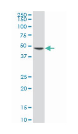 elongation protein 4 homolog (S. cerevisiae) (A01), Mouse anti-Human, Polyclonal Antibody, Abnova&trade;