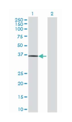 TruB pseudouridine (psi) synthase homolog 2 (E. coli), Mouse, Polyclonal