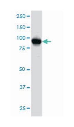 ATPase, Ca++ transporting, type 2C, member 1, Mouse, Clone: 2G1, Abnova