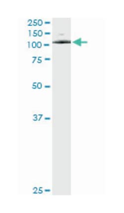 ATPase, Ca++ transporting, type 2C, member 1, Mouse, Clone: 2G1, Abnova