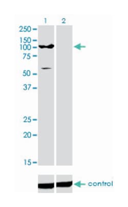 ATPase, Ca++ transporting, type 2C, member 1, Mouse, Clone: 2G1, Abnova
