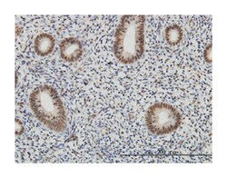 AF4/FMR2 family, member 4, Mouse, Clone: 2E12, Abnova 100&mu;g; Unlabeled:Antikroppar