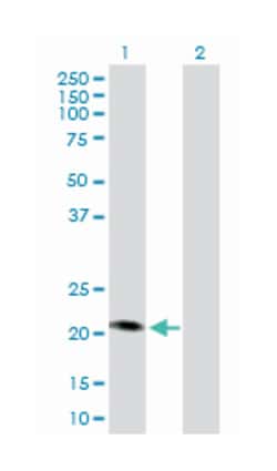 malonyl CoA:ACP acyltransferase (mitochondrial), Rabbit, Purified MaxPab