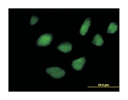 serine/threonine kinase 36, fused homolog (Drosophila), Mouse, Purified