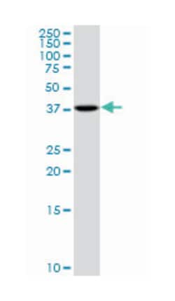phosphoserine aminotransferase 1, Mouse, Polyclonal Antibody, Abnova 50&mu;L;