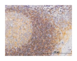 phosphoinositide-3-kinase, regulatory subunit 4, Mouse, Clone: 1B5, Abnova&trade;