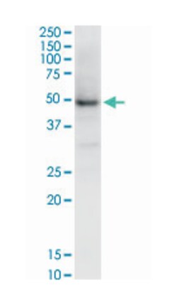 NAD(P) dependent steroid dehydrogenase-like, Mouse, Clone: 6E3, Abnova