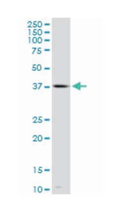 transcription factor Dp family, member 3, Mouse, Clone: 3F11, Abnova 100&mu;g;
