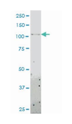 toll-like receptor 8, Mouse, Clone: 4C6, Abnova&trade;