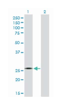 cytochrome b5 reductase 2, Mouse, Purified MaxPab Polyclonal Antibody,