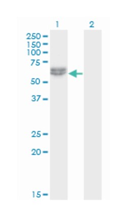 nemo-like kinase, Mouse, Clone: 2B11, Abnova 100&mu;g; Unlabeled:Antibodies,