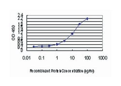 sterile alpha motif and leucine zipper containing kinase AZK, Mouse, Clone: