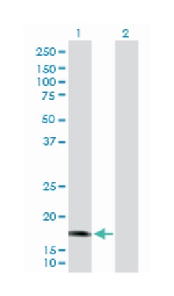 CALML5, Rabbit, Purified MaxPab Polyclonal Antibody, Abnova 100 &mu;g | Buy Online | Abnova | Fisher Scientific