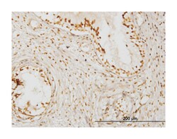 kelch domain containing 4, Mouse, Clone: 4G11, Abnova 100&mu;g; Unlabeled:Antibodies,