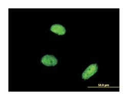 akirin 2, Mouse, Clone: 3D9, Abnova 100&mu;g; Unlabeled:Antibodies, Monoclonal