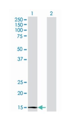 acyl-CoA thioesterase 13, Mouse, Polyclonal Antibody, Abnova 50&mu;L; Unlabeled:Antibodies,