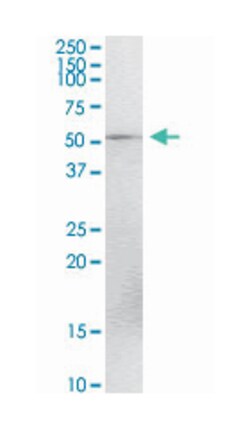 testis expressed 13A, Rabbit, Purified MaxPab Polyclonal Antibody, Abnova 100 &mu;g | Buy Online | Abnova Corporation | Fisher Scientific