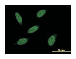 RNF20 (B01), Mouse anti-Human, Polyclonal Antibody, Abnova 50&mu;L; Unlabeled:Anticuerpos