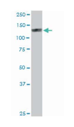 eukaryotic translation initiation factor 4E nuclear import factor 1 (B01),