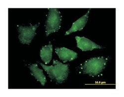 eukaryotic translation initiation factor 4E nuclear import factor 1 (B01),