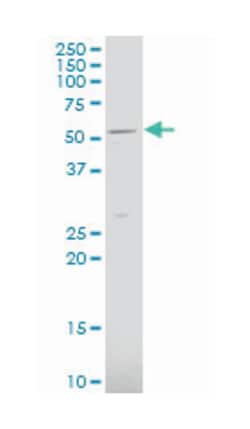 solute carrier family 2 (facilitated glucose transporter), member 9, Mouse, Polyclonal Antibody, Abnova 50 &mu;L | Buy Online | Abnova Corporation | Fisher Scientific