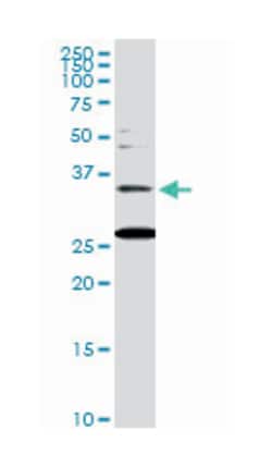 BarH-like homeobox 1, Mouse, Clone: 2B11, Abnova 100&mu;g; Unlabeled:Antibodies,