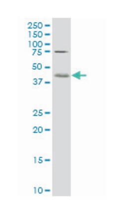 core 1 synthase, glycoprotein-N-acetylgalactosamine 3-beta-galactosyltransferase,