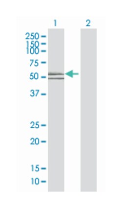cyclin L1, Mouse, Polyclonal Antibody, Abnova 50&mu;L; Unlabeled:Antibodies,
