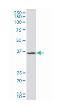 cytokine induced apoptosis inhibitor 1 (A01), Mouse anti-Human, Polyclonal Antibody, Abnova 50 &mu;L | Buy Online | Abnova Corporation | Fisher Scientific