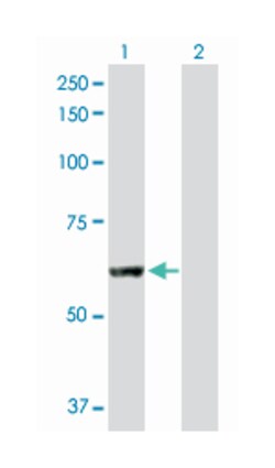 patatin-like phospholipase domain containing 2, Rabbit, Purified MaxPab