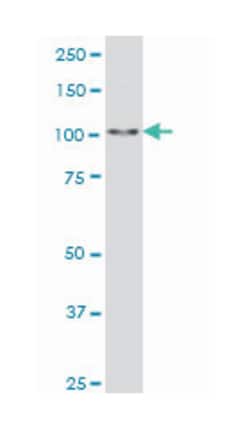 sal-like 4 (Drosophila), Mouse, Clone: 6E3, Abnova 100 &mu;g | Buy Online | Abnova Corporation | Fisher Scientific