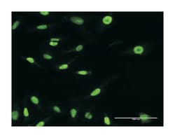 exportin 5, Rabbit, Purified MaxPab Polyclonal Antibody, Abnova 100 &mu;g | Buy Online | Abnova Corporation | Fisher Scientific