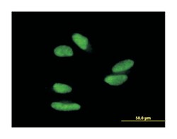 zinc finger protein 398, Mouse, Polyclonal Antibody, Abnova 50&mu;L; Unlabeled:Antibodies,