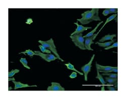 ALS2, Mouse, Clone: 4F10, Abnova&trade;