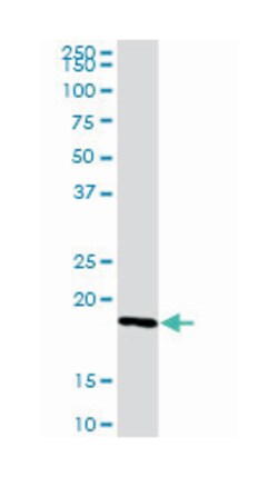 interleukin 21, Rabbit, Purified MaxPab Polyclonal Antibody, Abnova 100&mu;g;