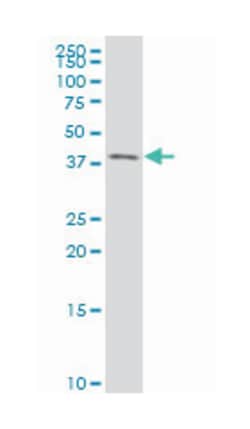 transcription factor B2, mitochondrial, Mouse, Polyclonal Antibody, Abnova
