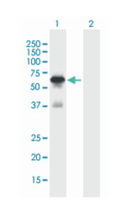 RNF25, Mouse, Polyclonal Antibody, Abnova 50&mu;L; Unlabeled:Antibodies,