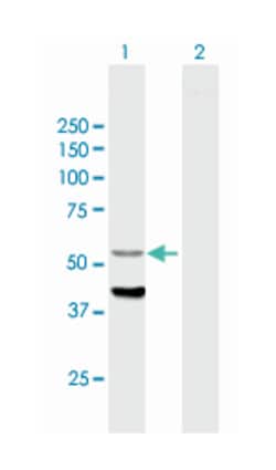 CYP4F12, Mouse, Purified MaxPab Polyclonal Antibody, Abnova 50&mu;g; Unlabeled:Antibodies,