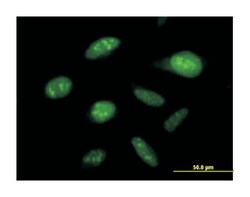 DEAD (Asp-Glu-Ala-Asp) box polypeptide 50, Mouse, Polyclonal Antibody,