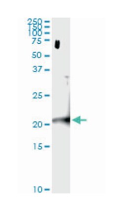 centromere protein M, Mouse, Clone: 4C12-2C8, Abnova 100&mu;g; Unlabeled:Antibodies,