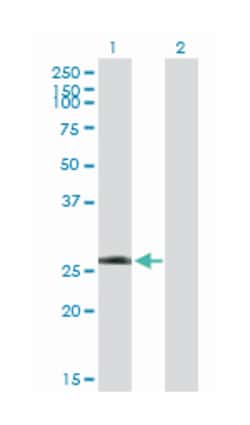 LRRK1, Mouse, Purified MaxPab&trade; Polyclonal Antibody, Abnova&trade;